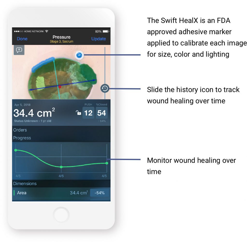 swiftcapture