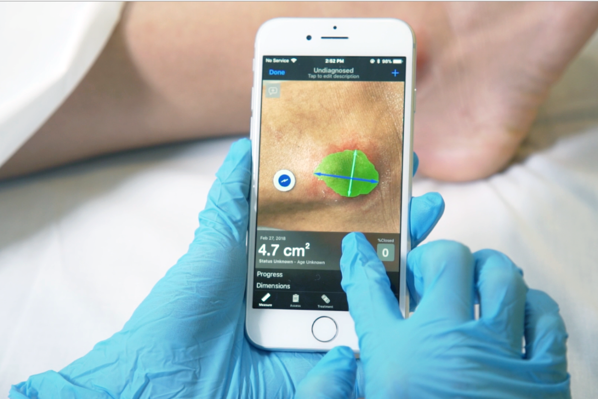 Wound Measurement, Assessment, and Documentation 101 - Swift