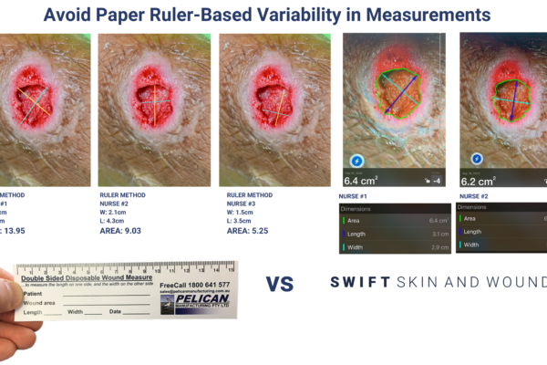 Examples of paper-based variability in measuring wounds