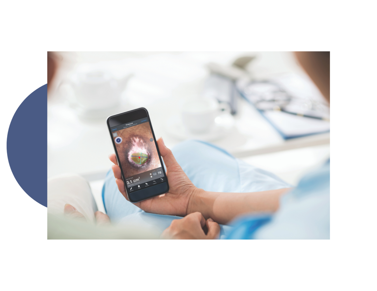 Patient Viewing Swift Skin and Wound App