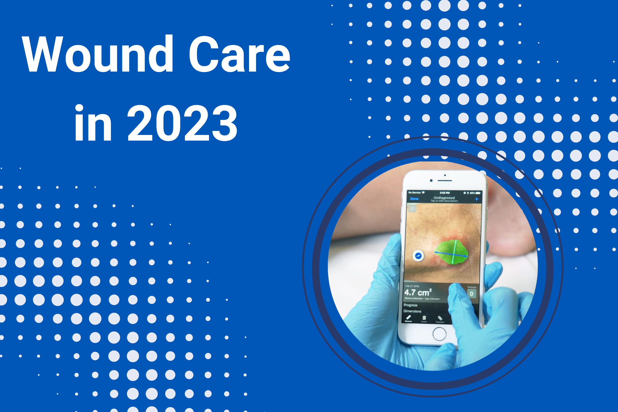 Wound Care in 2023