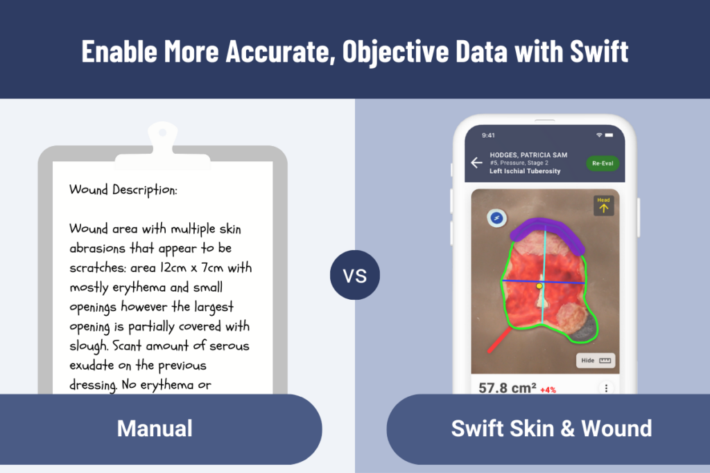 Enable More Accurate, Objective Wound Data with Swift