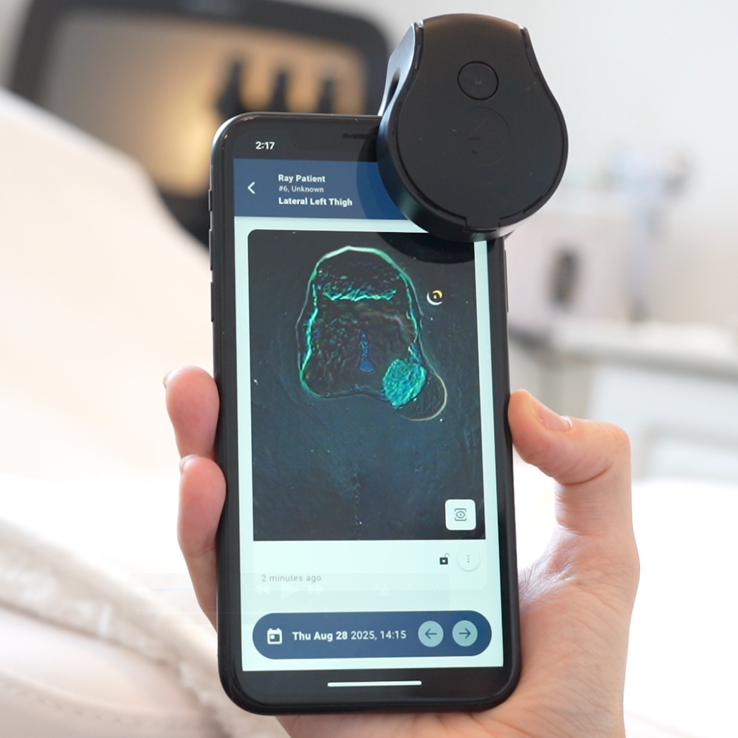 Swift Ray 1 with bacterial imaging